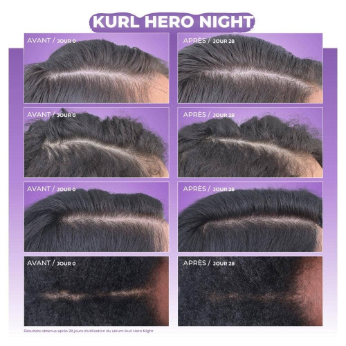 Sérum Nuit Loly Kurl Hero - Renforce & Répare Cuir Chevelu